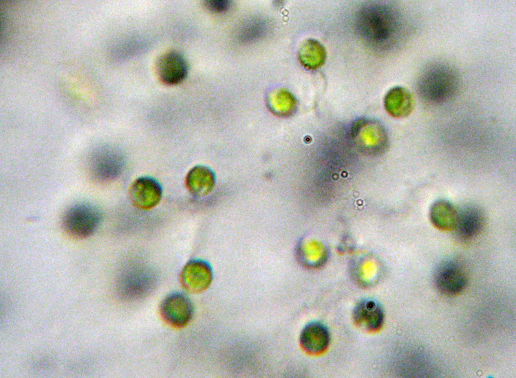 Forse Mucidosphaerium pulchellum [ Dictyosphaerium sp. ]